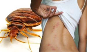 How bedbug affects human body