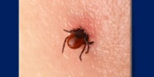 ticks