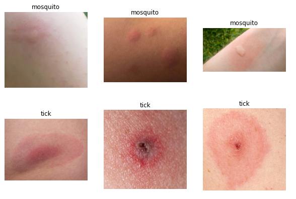 Bug Bites That Leave Water Blisters PFEH
